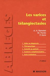 Les varices et télangiectasies