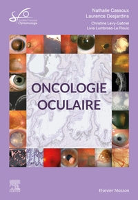 Oncologie oculaire