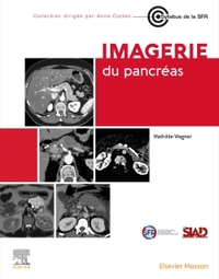 IMAGERIE DU PANCREAS