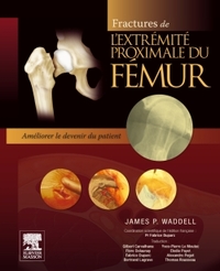 Fractures de l'extrémité proximale du fémur