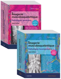 IMAGERIE MUSCULOSQUELETTIQUE - PACK 2 VOLUMES