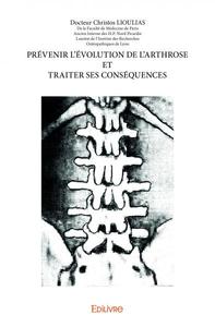 Prévenir l'évolution de l'arthrose et traiter ses conséquences