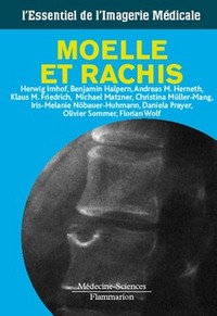 Moelle et rachis