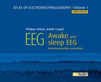Atlas of electroencephalography - Volume 1