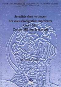 ACTUALITES DANS LES CANCERS DES VOIES AERODIGESTIVES SUP.