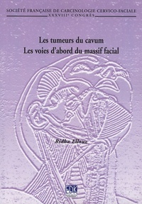 TUMEURS DU CAVUM ( LES) - LES VOIES D'ABORD DU MASSIF FACIAL