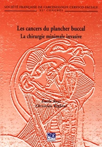 CANCERS DU PLANCHER BUCCAL (LES)