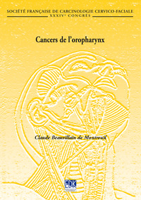 CANCERS DE L'OROPHARYNX