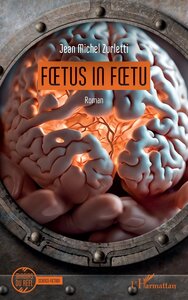 Foetus in foetu