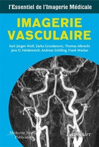 Imagerie vasculaire