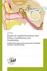 ETUDE ET IMPLEMENTATION DES FILTRES COCHLEAIRES PAR ONDELETTES