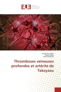 Thromboses veineuses profondes et arterite de Takayasu