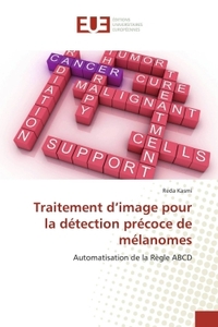 Traitement d image pour la détection précoce de mélanomes