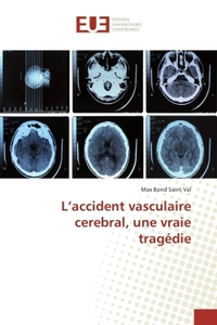 L'accident vasculaire cerebral, une vraie tragédie