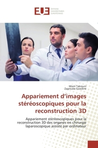 Appariement d'images stereoscopiques pour la reconstruction 3D