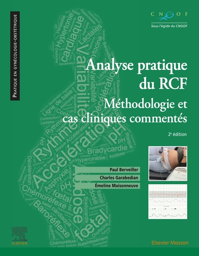 Analyse pratique du RCF : rythme cardiaque foetal - Méthodologie et cas cliniques commentés