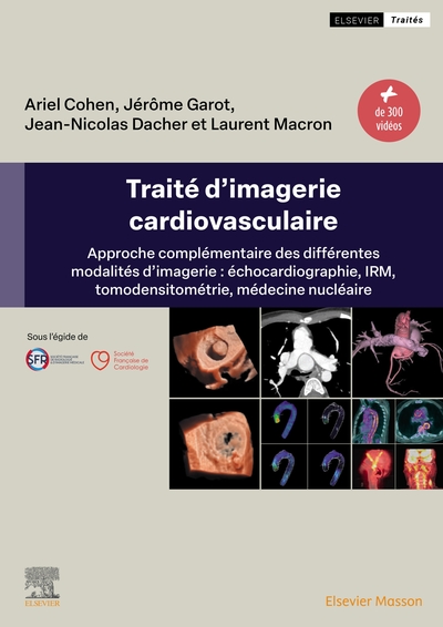 Traité d'imagerie cardiovasculaire - Approche complémentaire des différentes modalités d'imagerie : échocardiographie, IRM, tomodensitomé