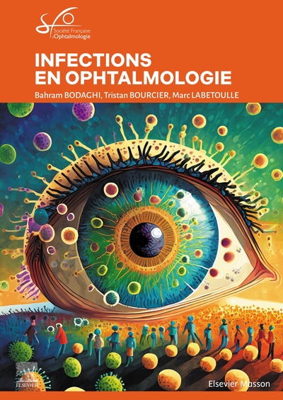 Infections en ophtalmologie - Rapport SFO 2024