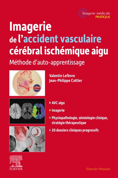 Imagerie de l'accident vasculaire cérébral ischémique aigu - Méthode d'auto-apprentissage