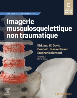 Imagerie musculosquelettique non traumatique
