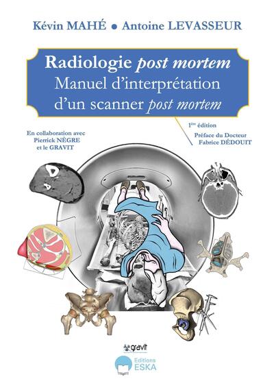 Radiologie post mortem - Manuel d'interprétation d'un scanner post mortem