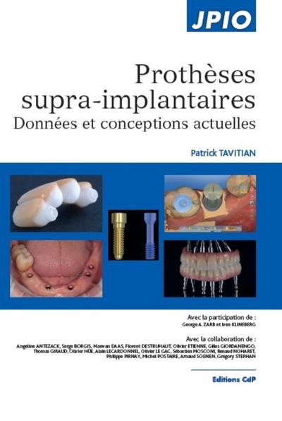 Prothèses supra-implantaires - Données et conceptions actuelles