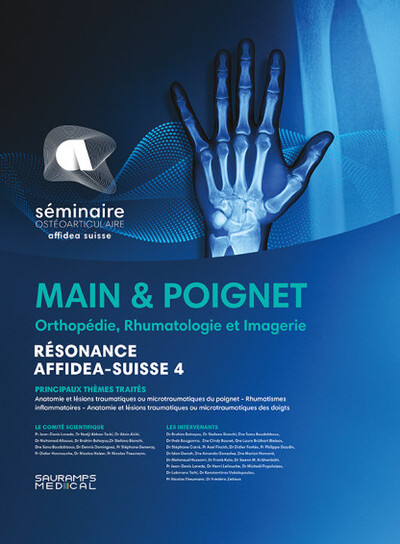 Main & poignet. Orthopédie, Rhumatologie. Imagerie - Résonance Affidea Suisse 4