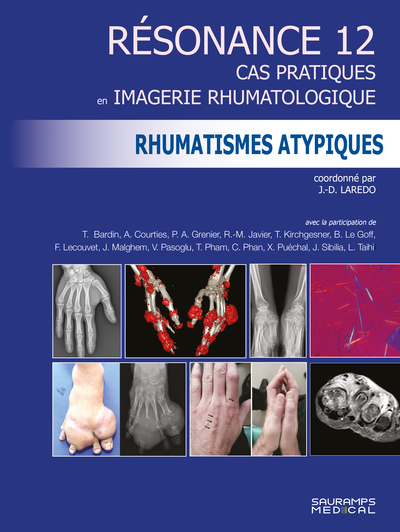 Résonance 12 - Rhumatismes atypiques - Cas pratiques en imagerie rhumatologique