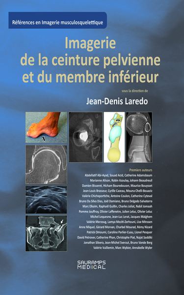 Imagerie de la ceinture pelvienne et du membre inférieur