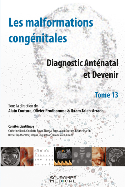 Les malformations congénitales - Diagnoctic Anténatal et Devenir T 13 - Les malformations congénitales T 13