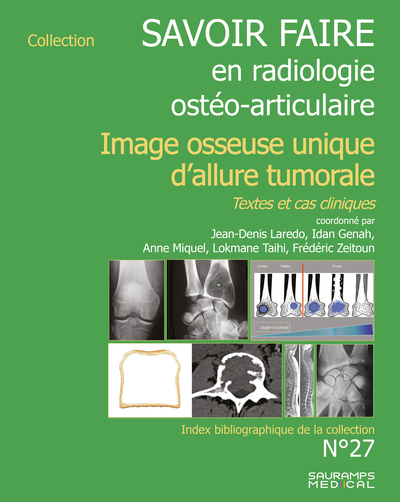 Savoir faire en imagerie ostéo articulaire n° 27 - Imagerie osseuse unique d'allure tumorale