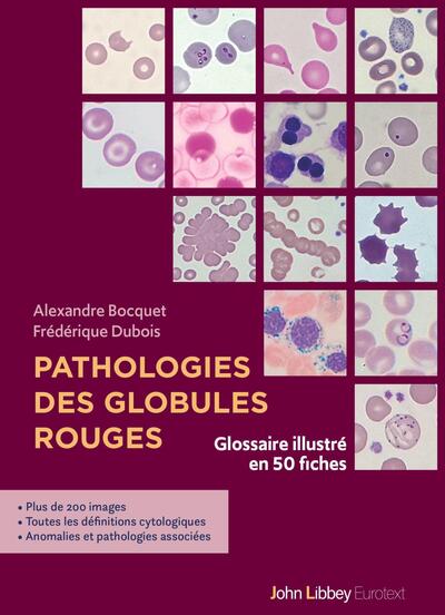 Pathologies des globules rouges - Glossaire illustré en 50 fiches