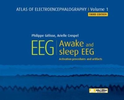 Atlas of electroencephalography - Volume 1 - EEG - Awake and sleep EEG - Activation Procedures and Artifacts