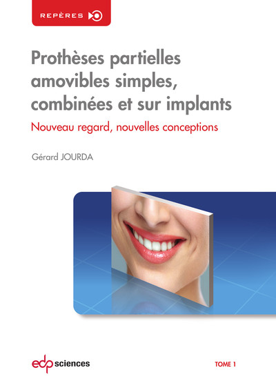 PROTHESES PARTIELLES AMOVIBLES T1 - Simples, combinées et sur implant