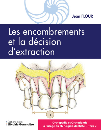 Orthopédie et Orthodontie à l'usage du l'usage du Chirurgien dentiste T2 - Les encombrements la décision d'extraction