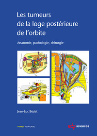 Image de TUMEURS DE LA LOGE POSTERIEURE DE L'ORBITE