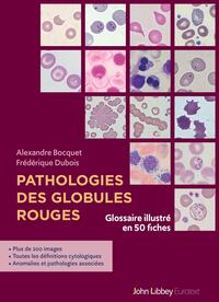 Picture of Pathologies des globules rouges