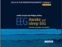 Image de EEG - AWAKE AND SLEEP EEG