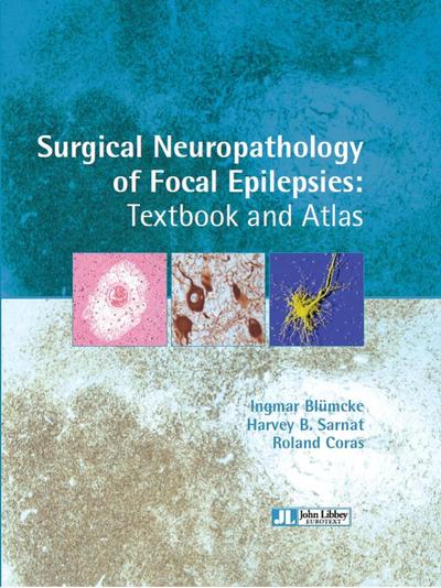 Picture of Surgical neuropathology of focal epilepsies