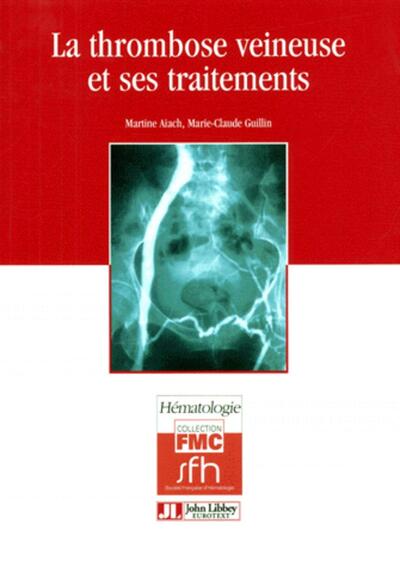 Image de Thrombose Veineuse