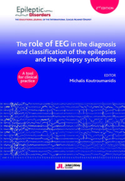 Picture of The role of EEG in the diagnosis and classification of the epilepsies and the epilepsy syndromes