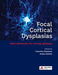 Picture of Focal Cortical Dysplasias