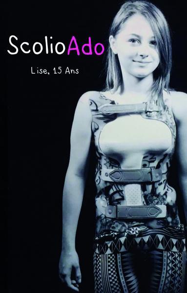Picture of Scolioado lise, 15 ans
