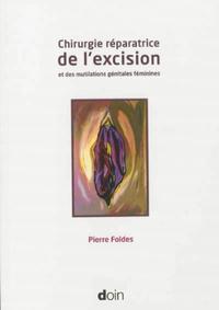 Picture of Chirurgie réparatrice de l'excision et des mutilations génitales féminines