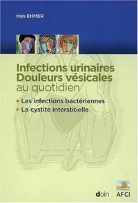 Image de Infections urinaires - Douleurs vésicales au quotidien