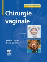 Image de Chirurgie vaginale