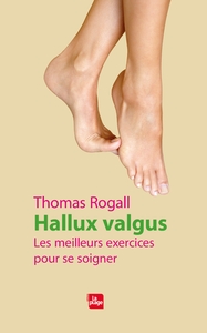 Image de Hallux valgus