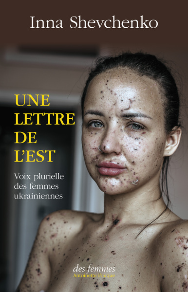 Image de Une lettre de l'Est