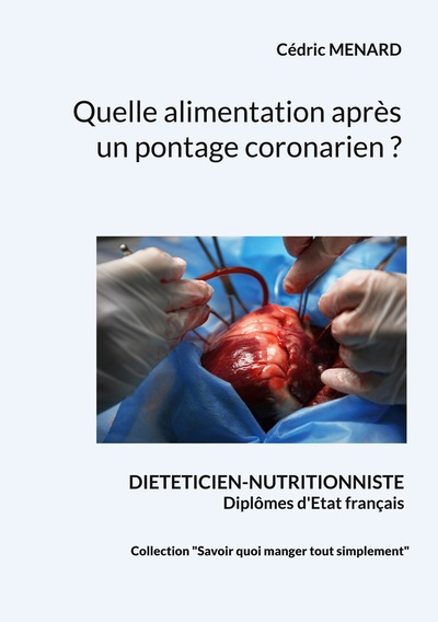 Image de Quelle alimentation après un pontage coronarien ?