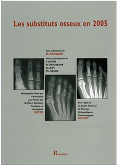 Image de Les substituts osseux en 2005